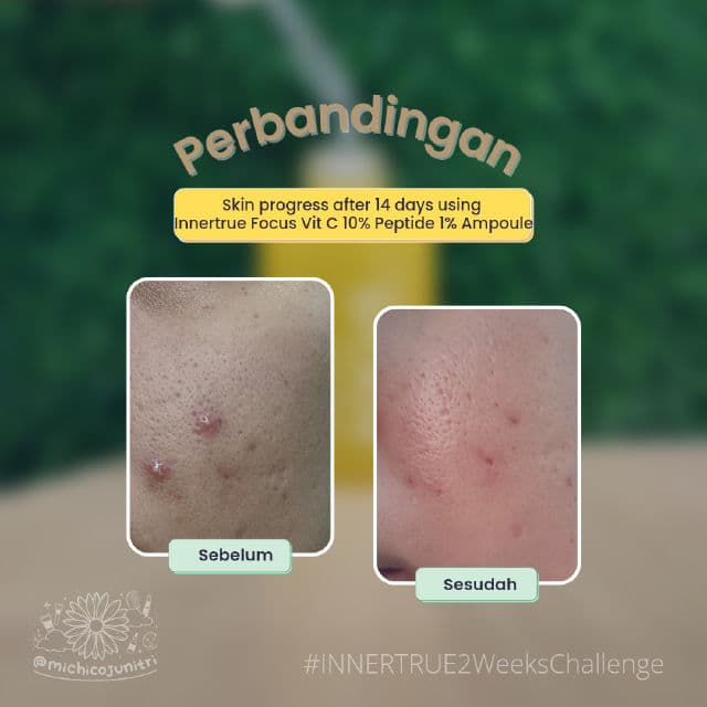 Innertrue Focus Vitamin C 10% + Peptide 1% Ampoule review photo by Michico