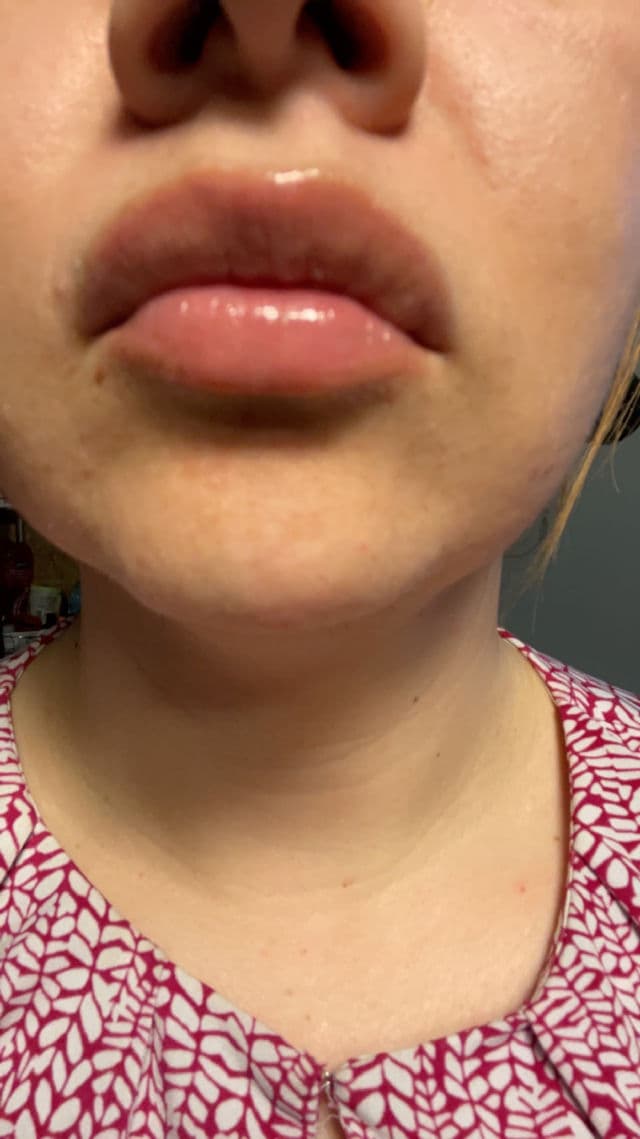 Too Faced Lip Injection Extreme Lip Plumper review photo by juliemar