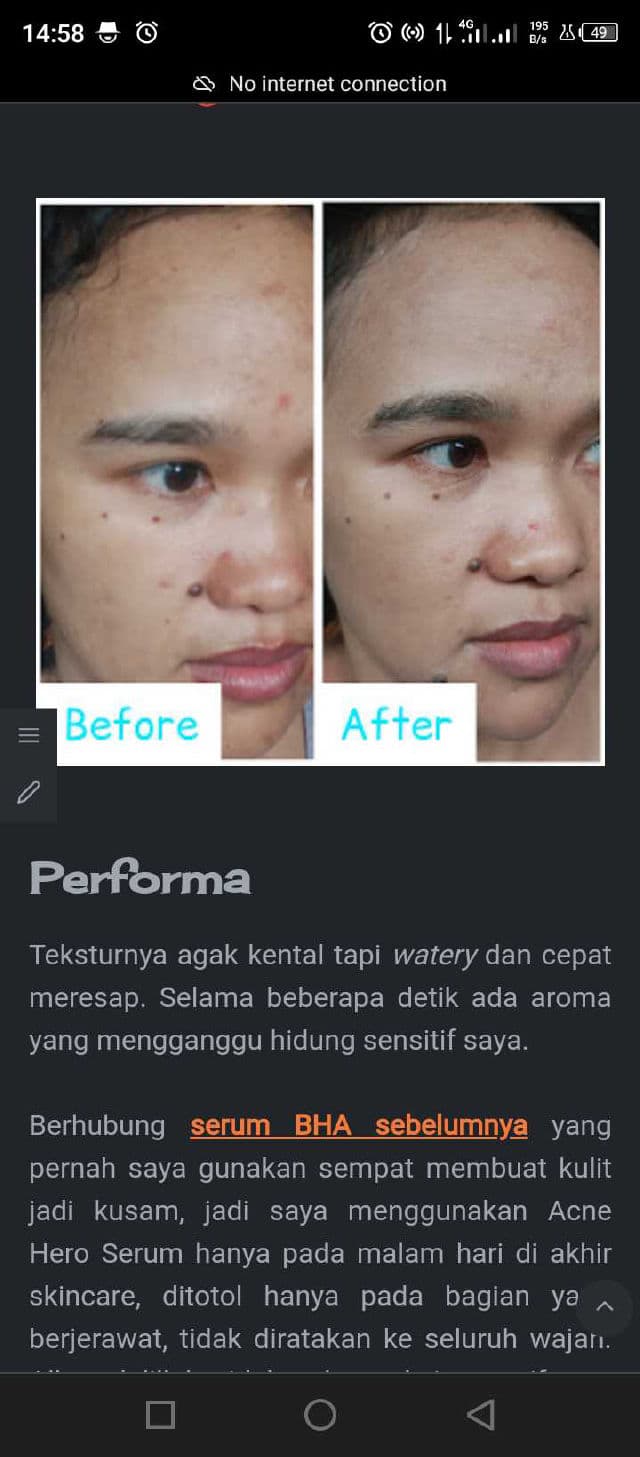 Joylab Acne Hero Serum review photo by ceritaoryza