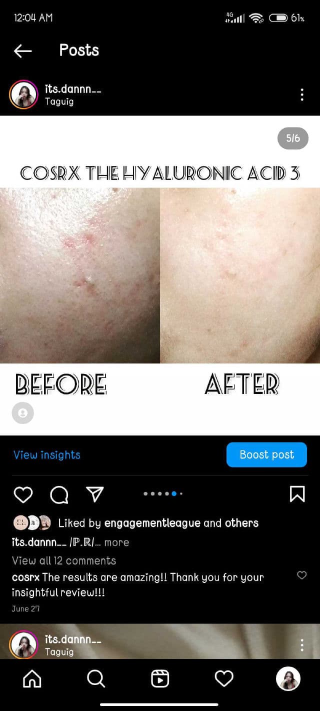 COSRX The Hyaluronic Acid 3 Serum review photo by Skincarewithdannn