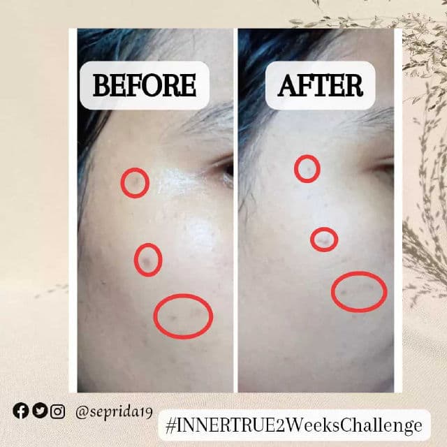 Innertrue Focus Vitamin C 10% + Peptide 1% Ampoule review photo by sepridawati