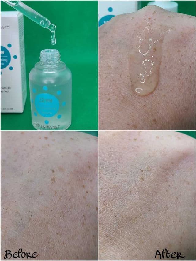 Meta Foret 12PM Brightening Serum review photo by Researching4Beauty