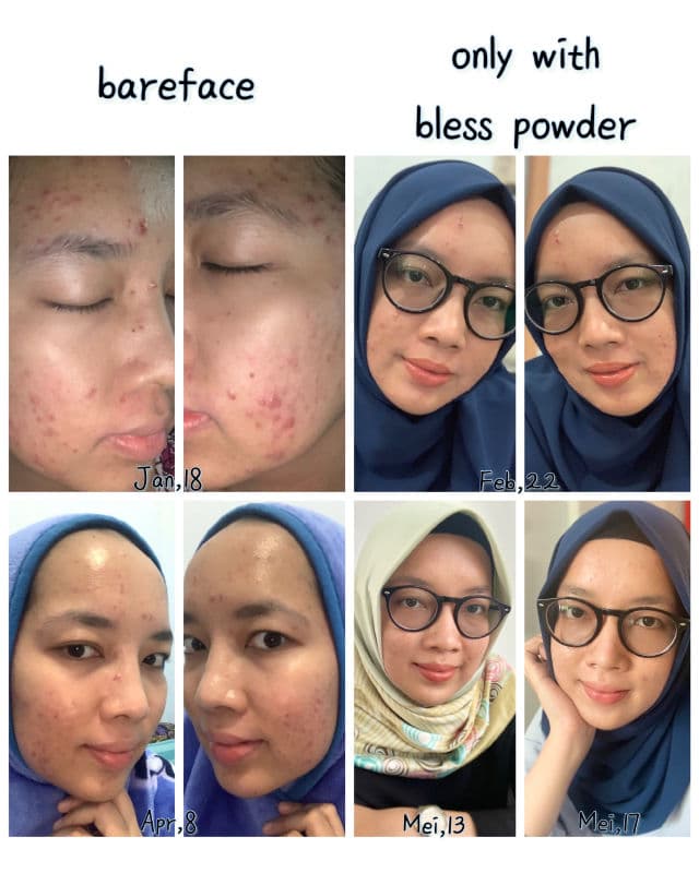 QV Skincare Moisturising Cream review photo by Siitha