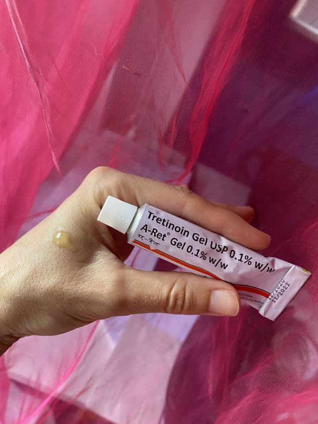 Menarini Tretinoin Gel USP A-Ret 0.1% review photo by kazantipmysoul
