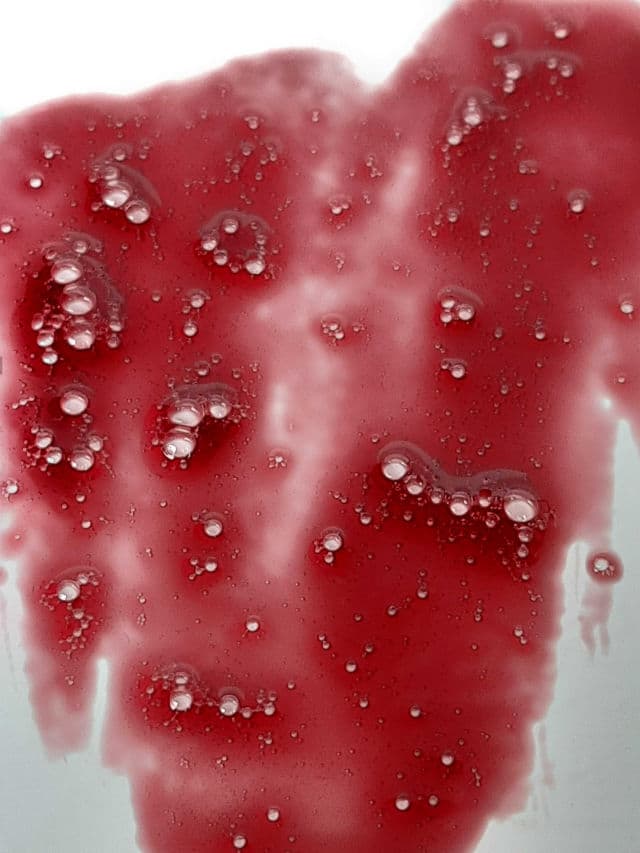 The Ordinary AHA 30% + BHA 2% Peeling Solution review photo by lifestyleofsoma