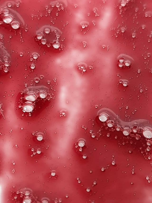 The Ordinary AHA 30% + BHA 2% Peeling Solution review photo by lifestyleofsoma