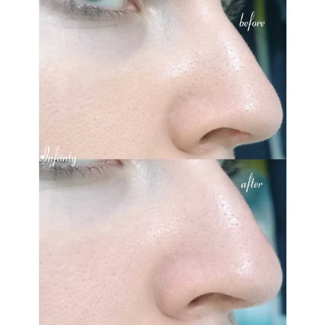 ELIZAVECCA Carbonated Bubble Clay Mask review photo by TanyaKbeauty