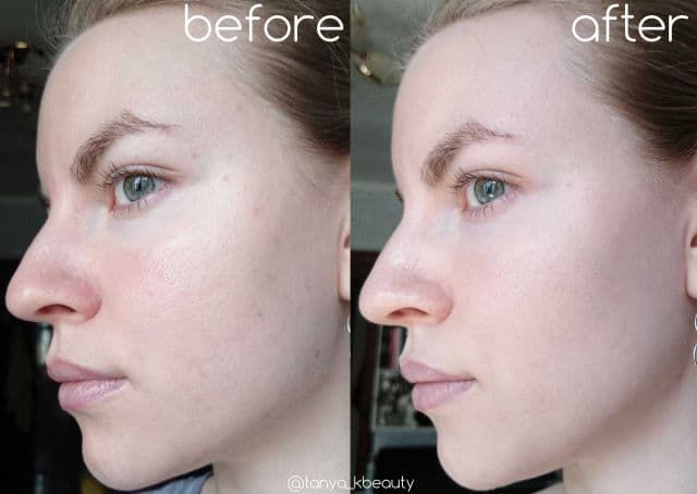 Art&Fact Azelaic Acid 5% + Calendula Officinalis Flower Extract 0.5% + Aloe Barbadensis Leaf Extract 0.5% Moisturizing & Seboregulation Face Tonic review photo by TanyaKbeauty