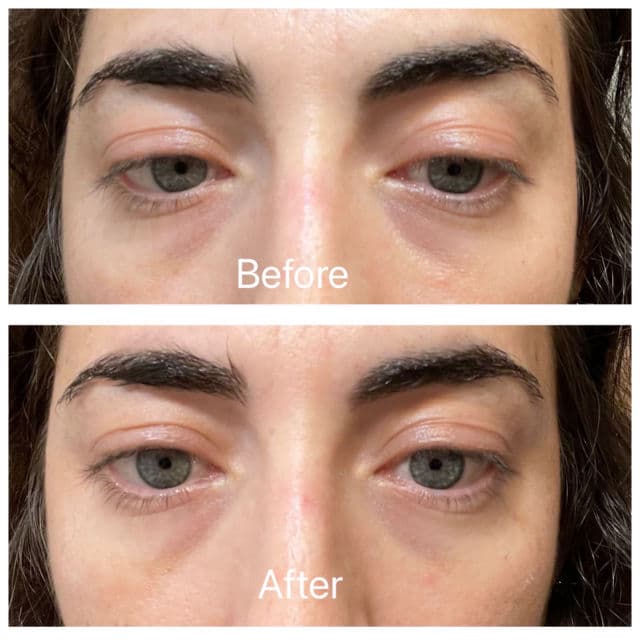 Dermalogica Awaken Peptide Eye Gel review photo by samplesfantx