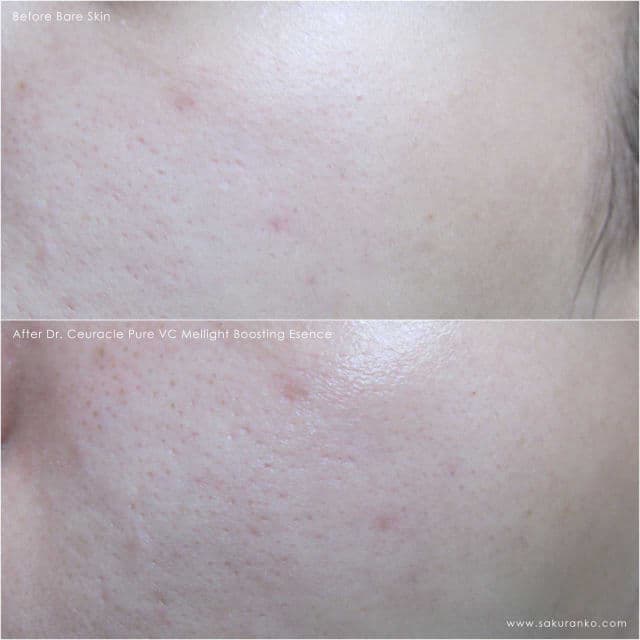 Dr. Ceuracle Pure VC Mellight Boosting Essence review photo by Sakuranko