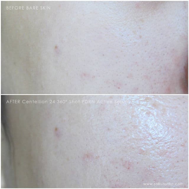 Centellian24 360° Shot PDRN Active Serum review photo by Sakuranko