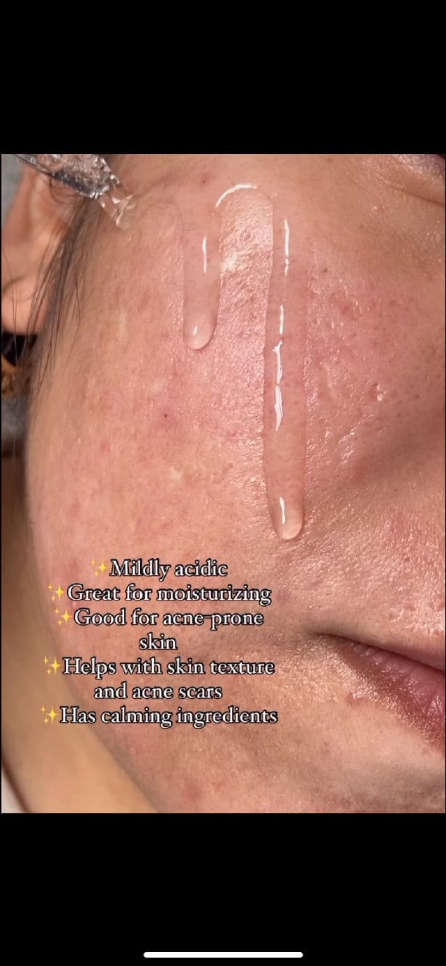 Meditherapy A Clearing Active Acne Serum review photo by krisss21
