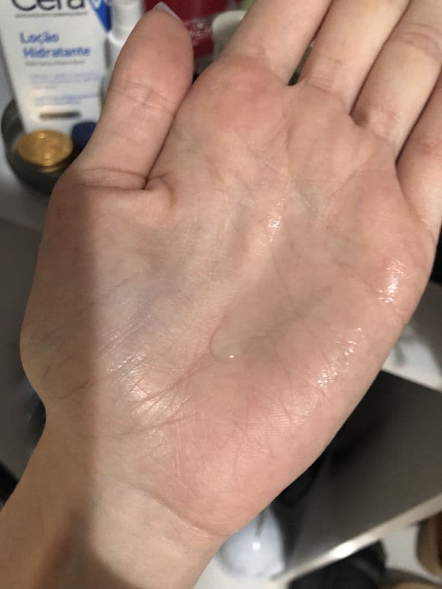 INNISFREE Bija Trouble Skin review photo by camilaguimaraes