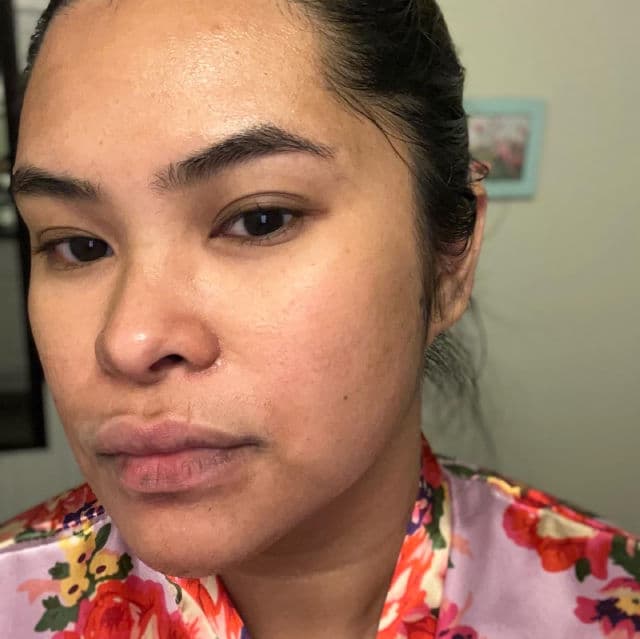 SKIN1004 ZOMBIE BEAUTY by SKIN1004 Bloody Peel review photo by VeronicaReviews