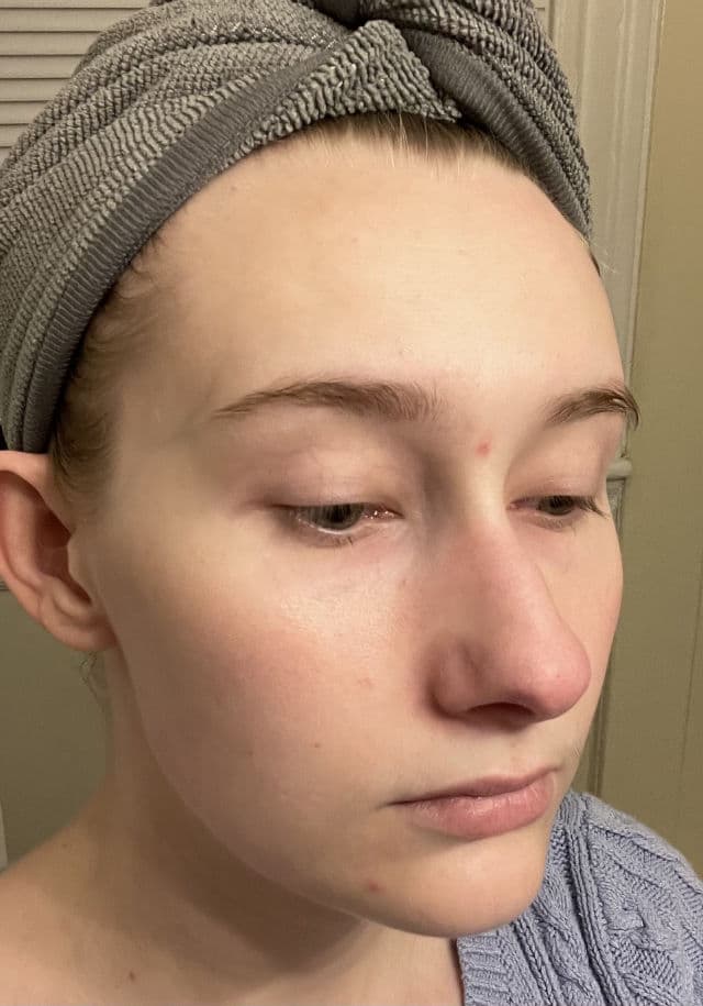 Dr. Ceuracle Tea Tree Purifine 95 Essence review photo by CaitlynF