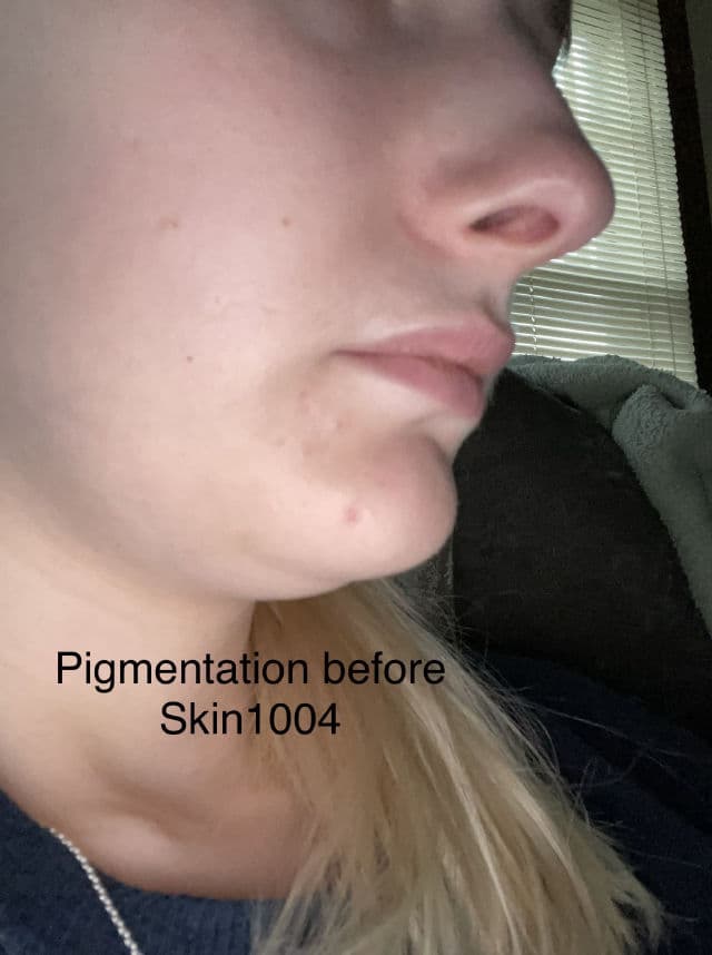 SKIN1004 Madagascar Centella Tone Brightening Capsule Ampoule review photo by CaitlynF