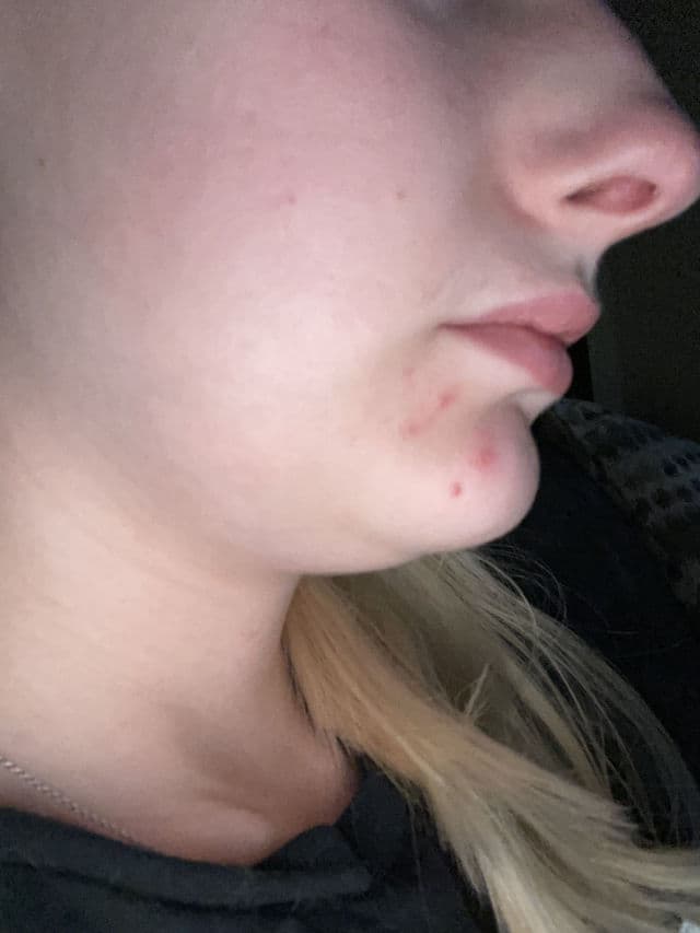 SKIN1004 Madagascar Centella Tone Brightening Capsule Ampoule review photo by CaitlynF