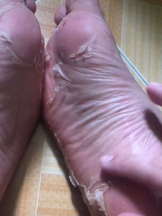 RtopR Mango Soft Moisturizing Foot Mask review photo by Yssaaa