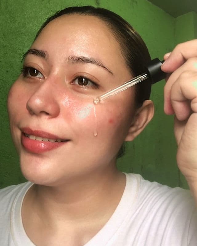 CHIYOU Terpineol Double Action Serum review photo by Yssaaa