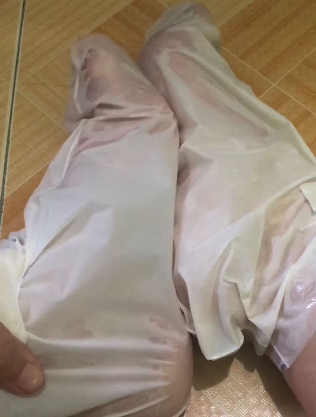 RtopR Mango Soft Moisturizing Foot Mask review photo by Yssaaa