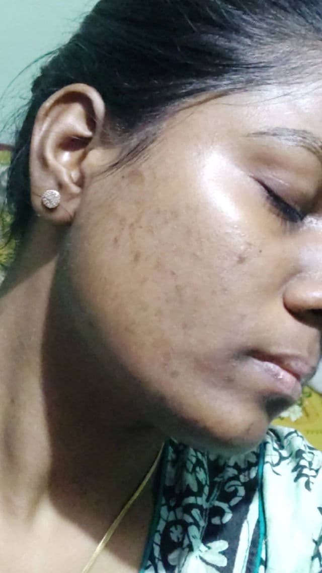 No.5 Glutathione Vitamin C Concentrated Serum product review