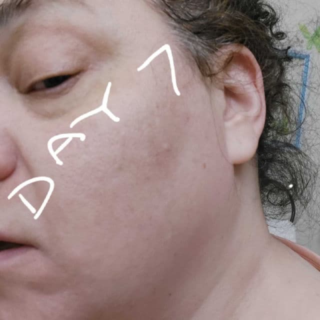 YEOUTH Glycolic Acid 30% Gel Peel review photo by Mirabellareviews