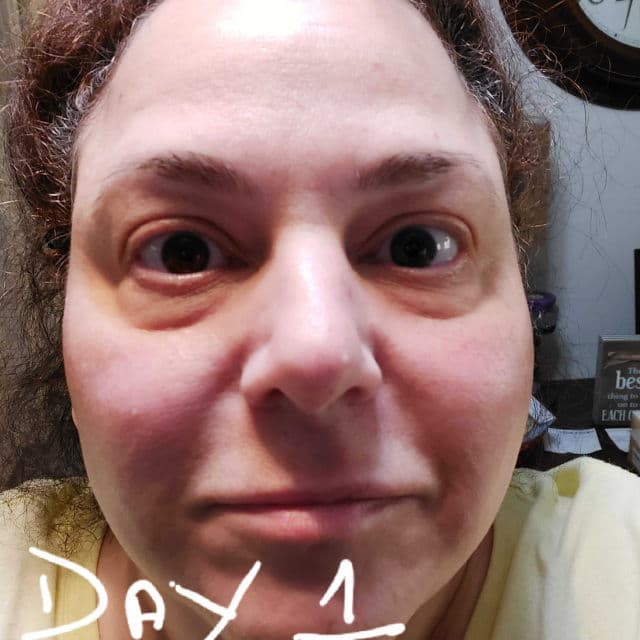 YEOUTH Glycolic Acid 30% Gel Peel review photo by Mirabellareviews