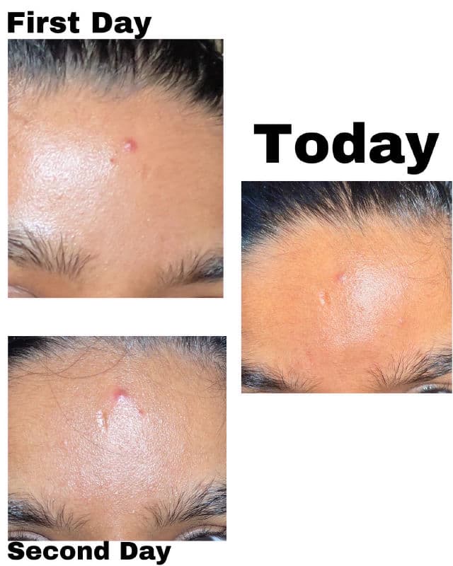 Mario Badescu Drying Patch review photo by Scarrr