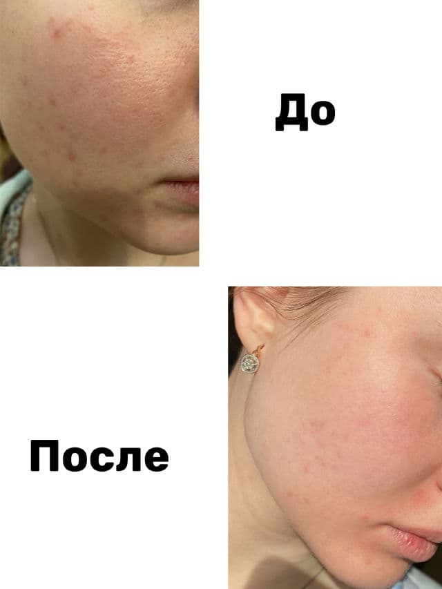 Sesderma Sensyses Cleanser Ros review photo by kondina