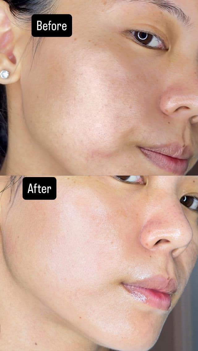 SKIN1004 Madagascar Centella Tone Brightening Capsule Ampoule review photo by ellulina