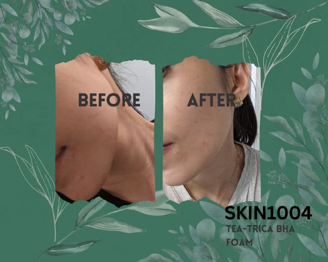 SKIN1004 Madagascar Centella Tea-Trica BHA Foam review photo by lioni'ka