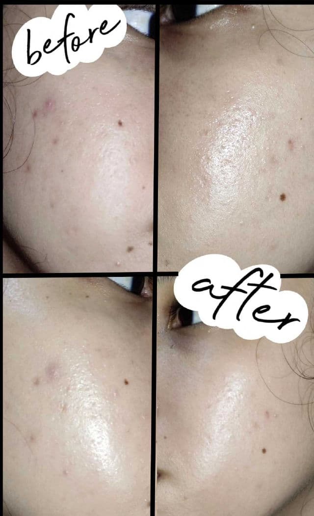 Madagascar Centella Soothing Cream product review