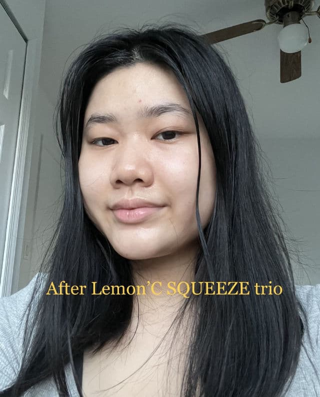 IT'S SKIN Lemon'C Squeeze Ampoule Toner review photo by glowyysunny
