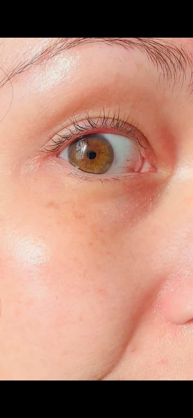 Dr. Brandt Needles No More No More Baggage review photo by Jadorimama