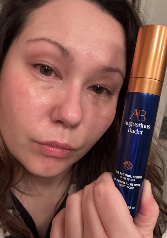 Augustinus Bader The Retinol Serum review photo by Jadorimama