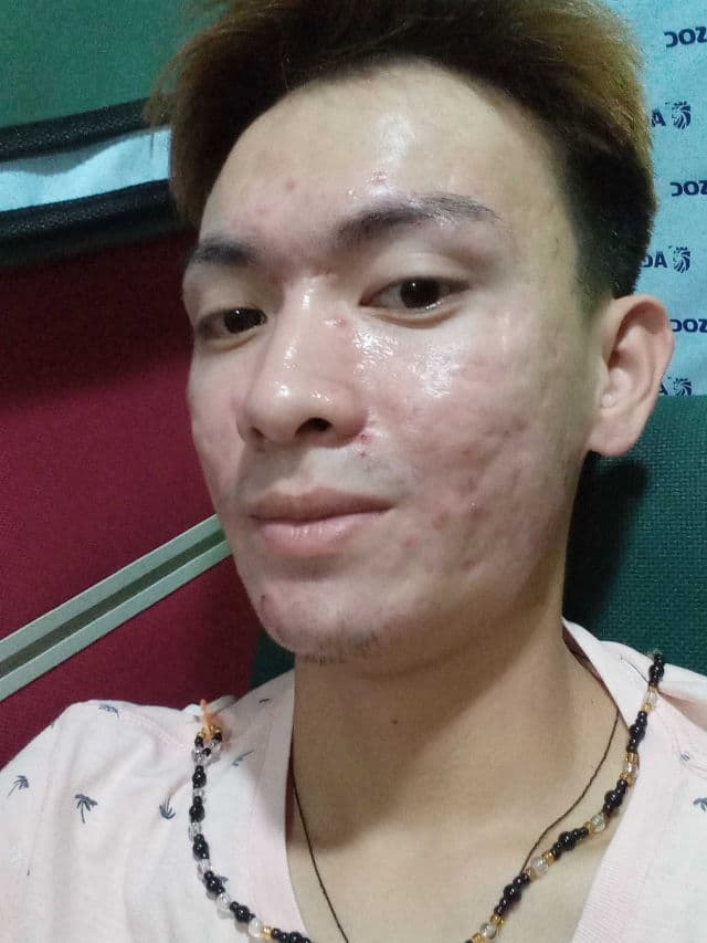 BELLAMONSTER Stress Out Solution Foam Cleanser review photo by Tieny