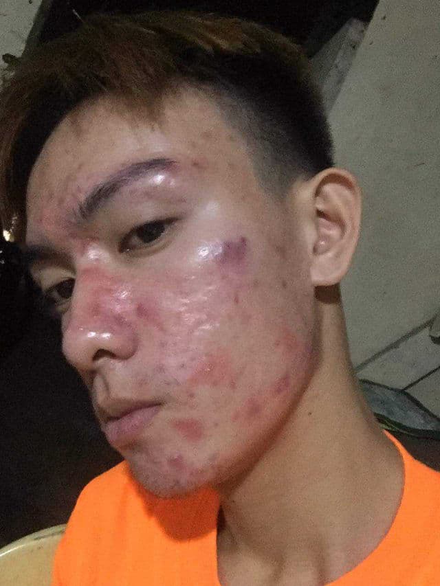 BELLAMONSTER Stress Out Solution Foam Cleanser review photo by Tieny