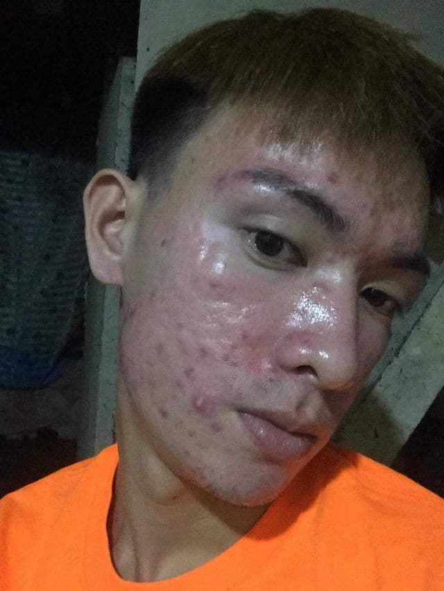 BELLAMONSTER Stress Out Solution Foam Cleanser review photo by Tieny