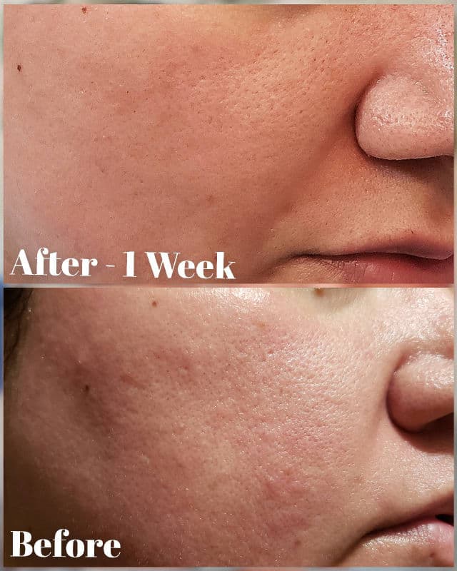 Meditherapy Vita Real Toning Enzyme Powder Cleanser review photo by AlottaxReviews