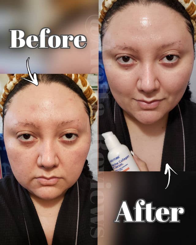 ASIS-TOBE Marine Collagen 81 Serum review photo by AlottaxReviews