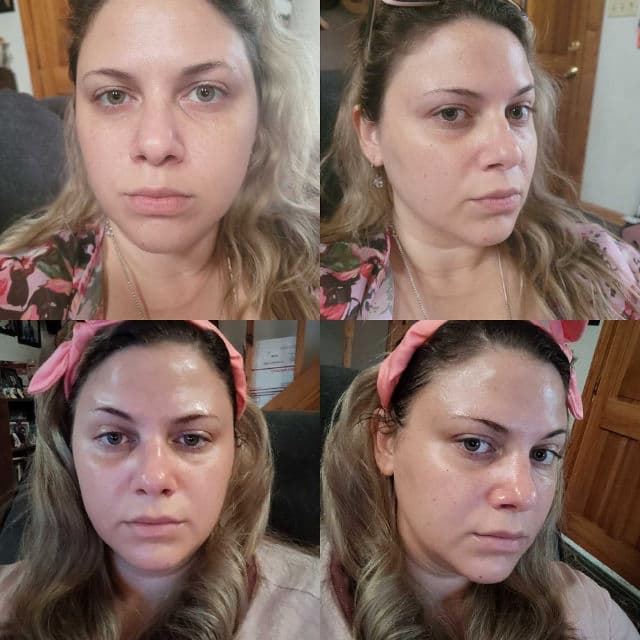 Heilo Skin Care Glycolic Lactic Tonic review photo by jamminbeauty91