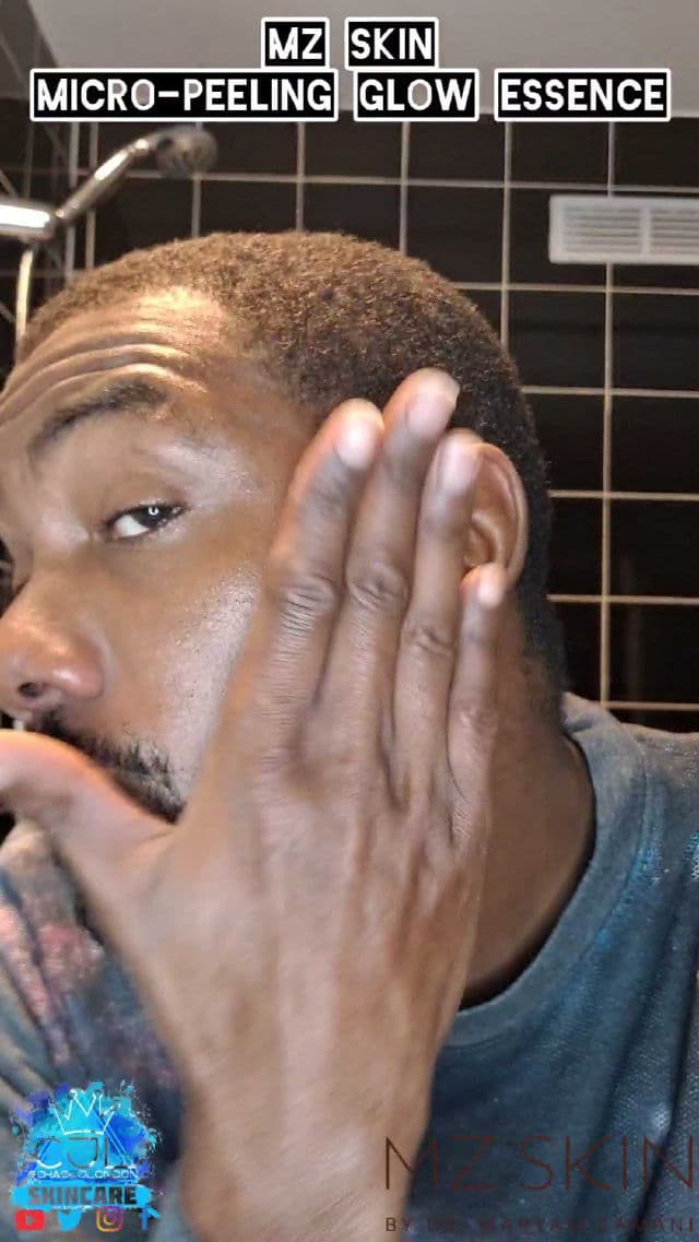 MZ Skin Micro-Peeling Glow Essence review photo by CHASEJLONDON