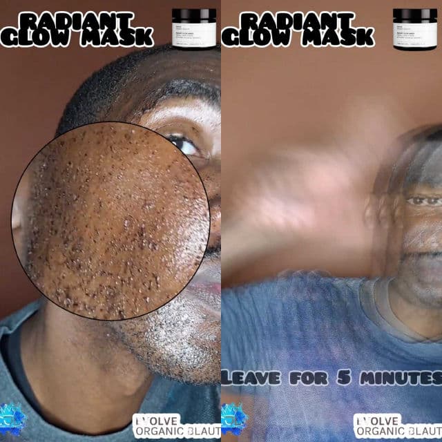 Evolve Organic Beauty Radiant Glow Organic Face Mask review photo by CHASEJLONDON