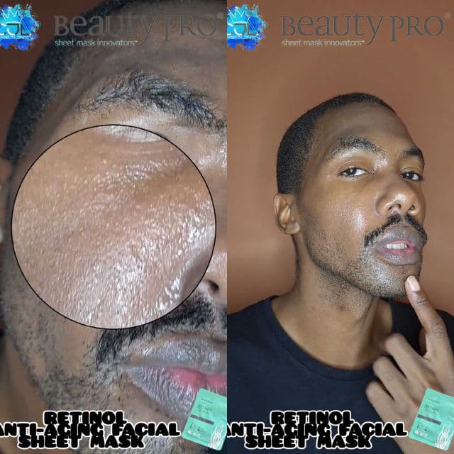 BeautyPro Retinol Facial Sheet Mask review photo by CHASEJLONDON