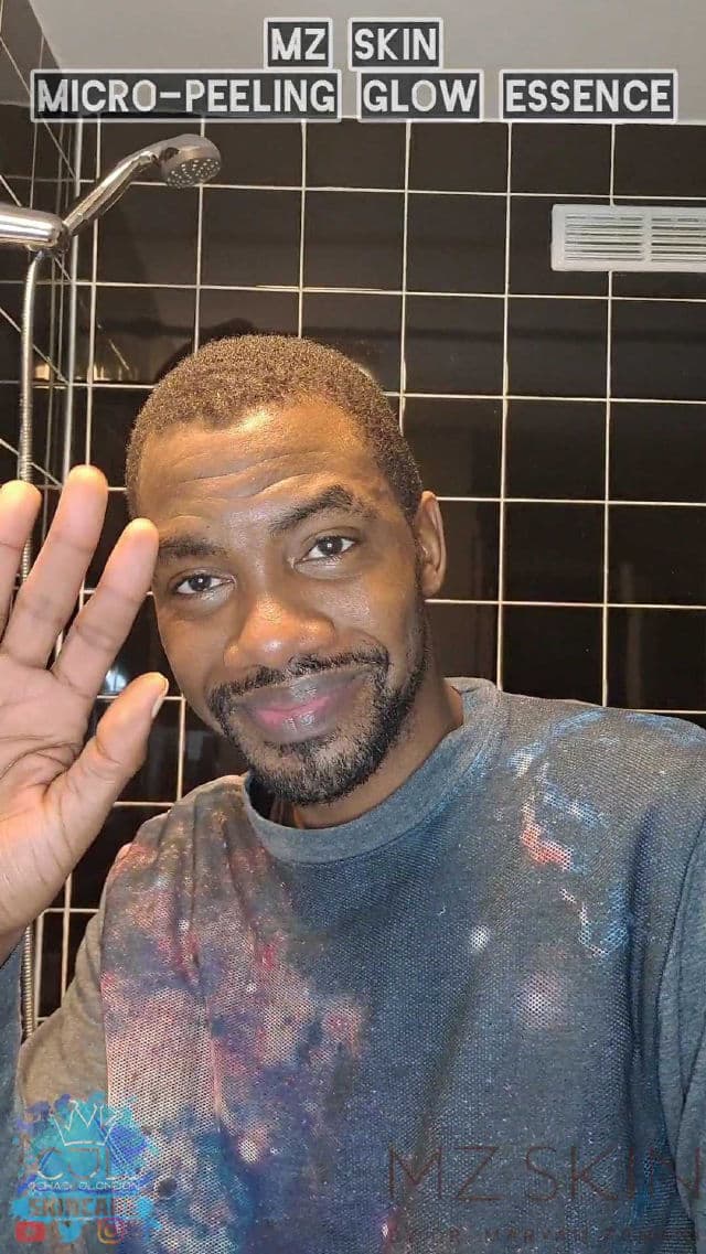 MZ Skin Micro-Peeling Glow Essence review photo by CHASEJLONDON