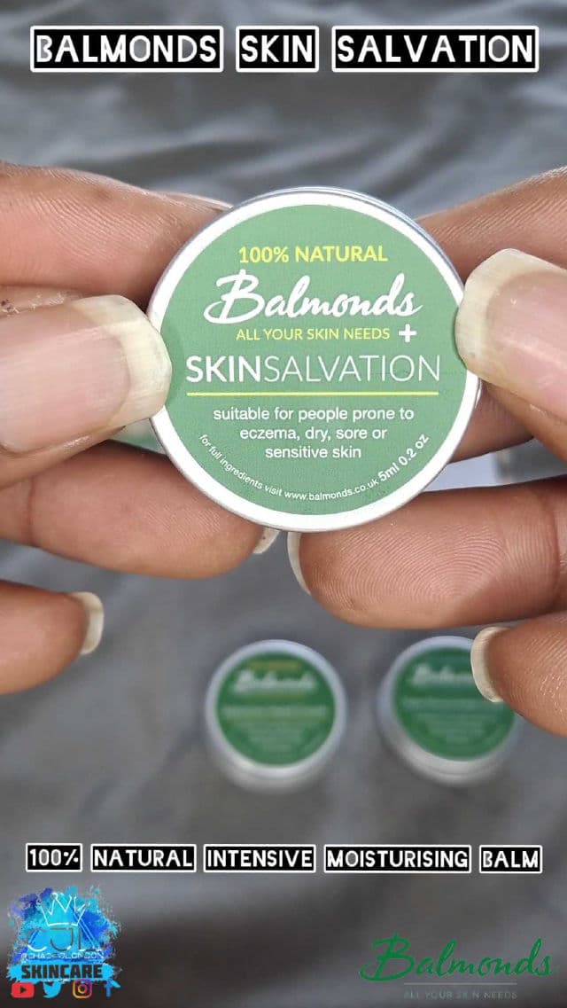 Balmonds Skin Salvation review photo by CHASEJLONDON