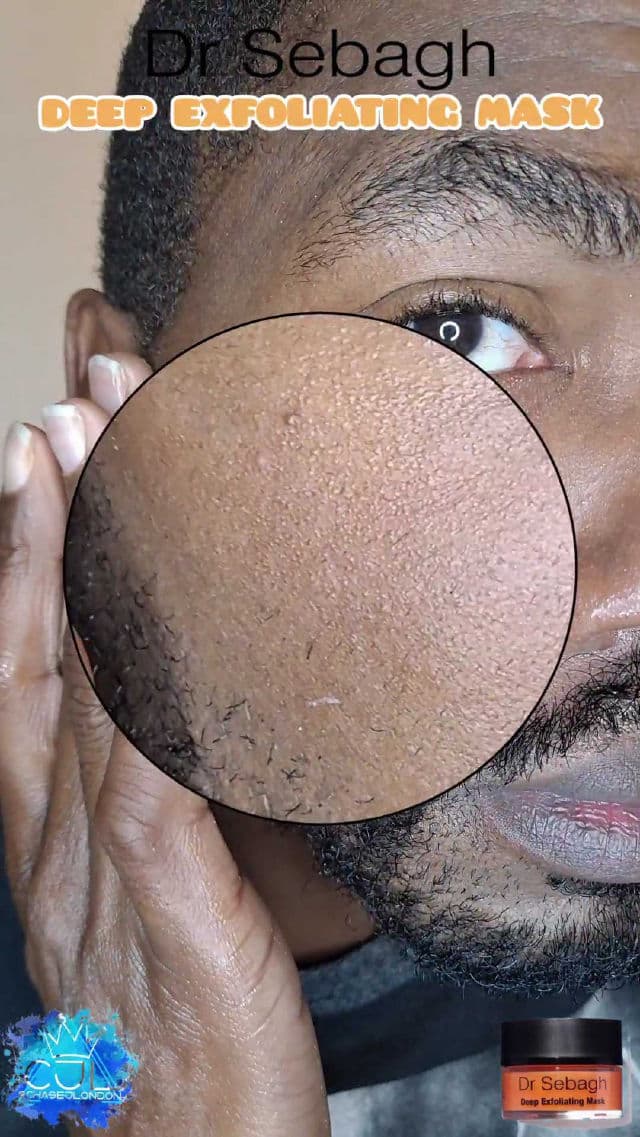 Dr. Sebagh Deep Exfoliating Mask review photo by CHASEJLONDON