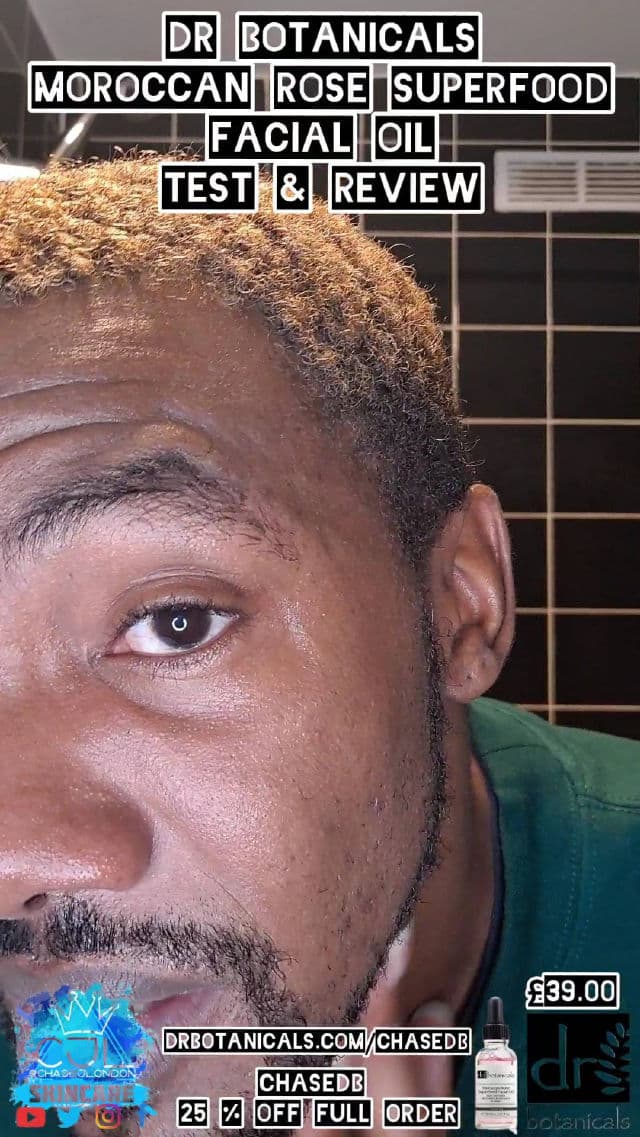 Dr. Botanicals Moroccan Rose Superfood Facial Oil review photo by CHASEJLONDON