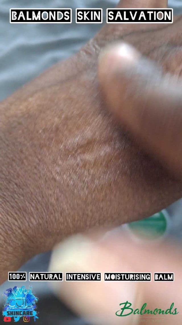 Balmonds Skin Salvation review photo by CHASEJLONDON