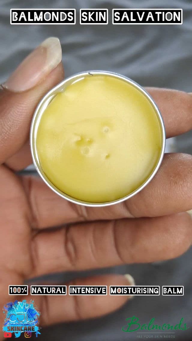 Balmonds Skin Salvation review photo by CHASEJLONDON